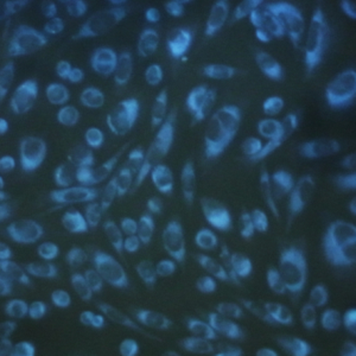 CytoSeeing（Reversible Cytoplasm Blue）