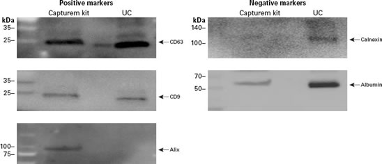 Capturem&trade; Extracellular Vesicle Isolation Kit